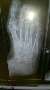 WP_20151203_09_56_26_Pro[1]